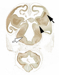 gene expression in the human embryonic brain