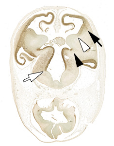 gene expression in the human embryonic brain