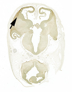 gene expression in the human embryonic brain