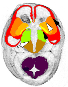 gene expression in the human embryonic brain