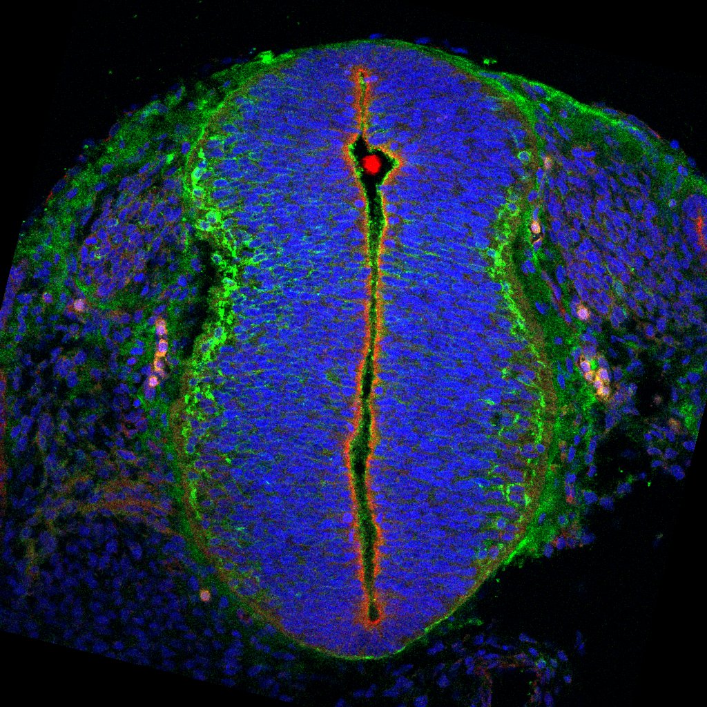 Gene expression in the human embryonic spinal cord