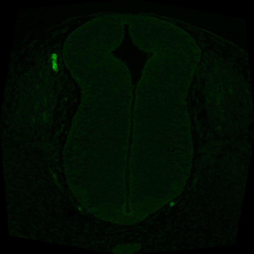 Protein expression in the human embryonic spinal cord