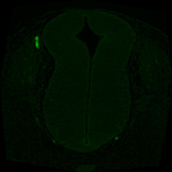 Protein expression in the human embryonic spinal cord