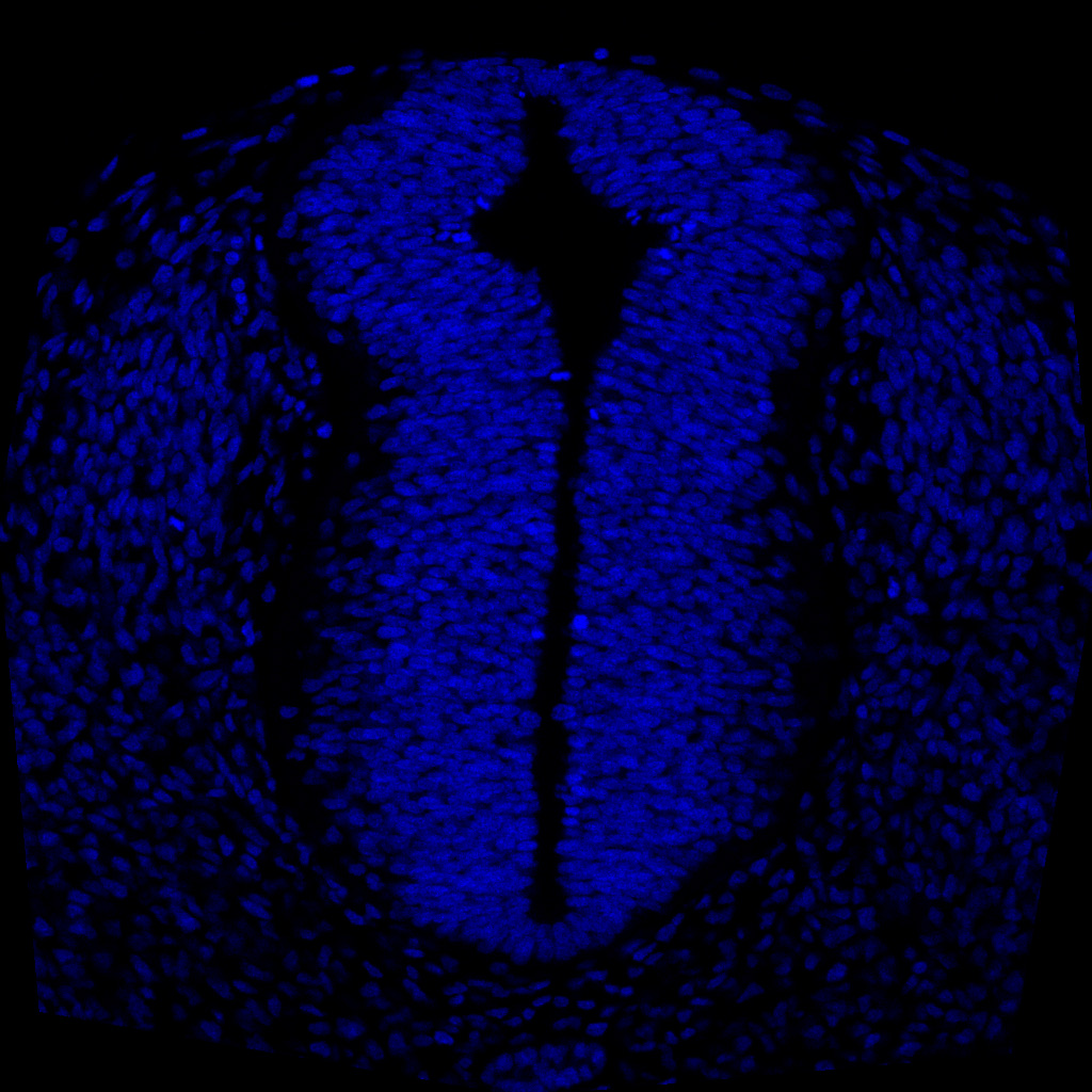 Protein expression in the human embryonic spinal cord