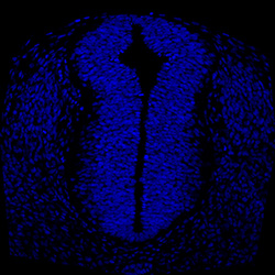 Protein expression in the human embryonic spinal cord