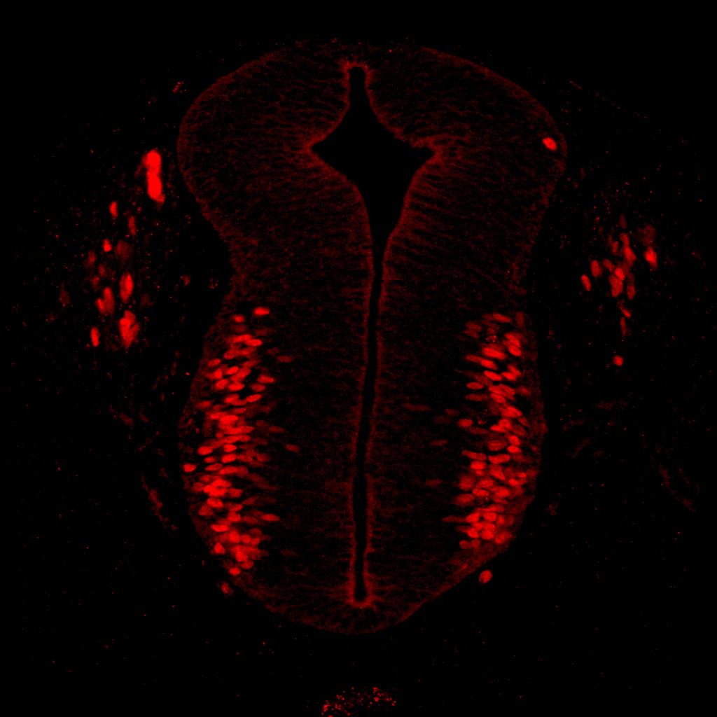 Protein expression in the human embryonic spinal cord