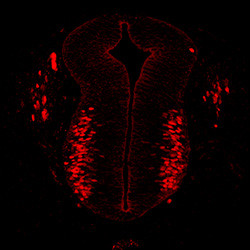 Protein expression in the human embryonic spinal cord