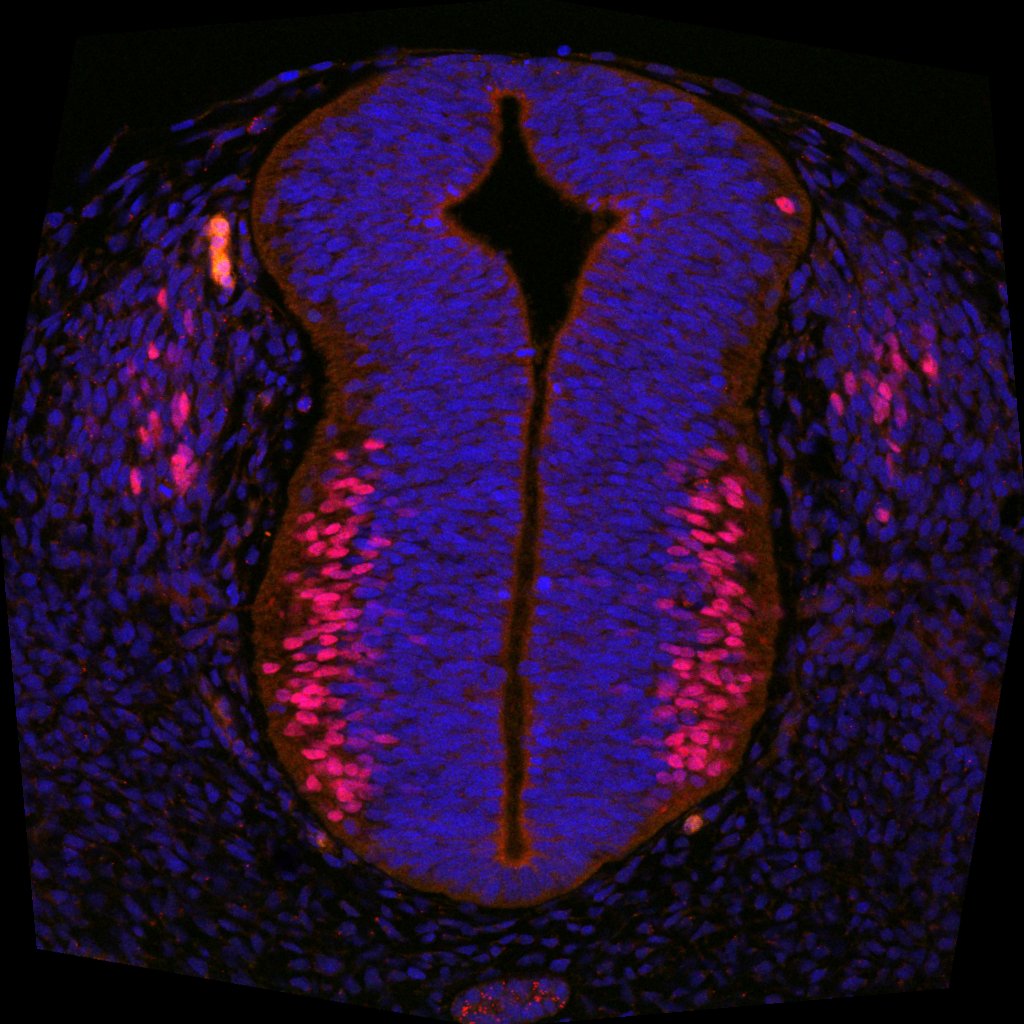 Protein expression in the human embryonic spinal cord