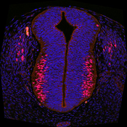 Protein expression in the human embryonic spinal cord