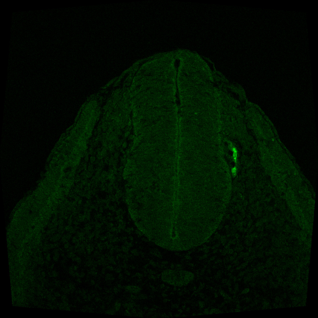 Protein expression in the human embryonic spinal cord