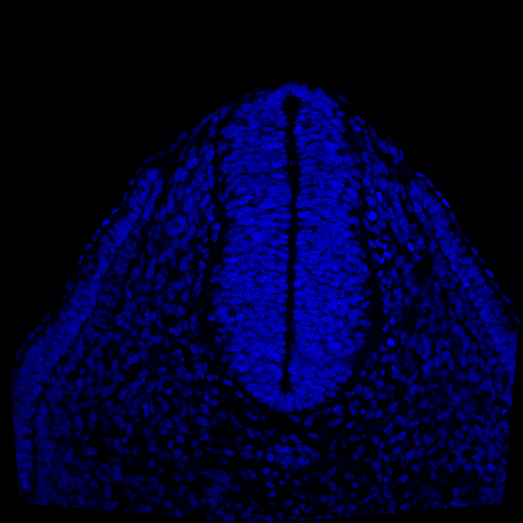 Protein expression in the human embryonic spinal cord