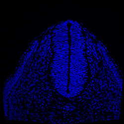 Protein expression in the human embryonic spinal cord