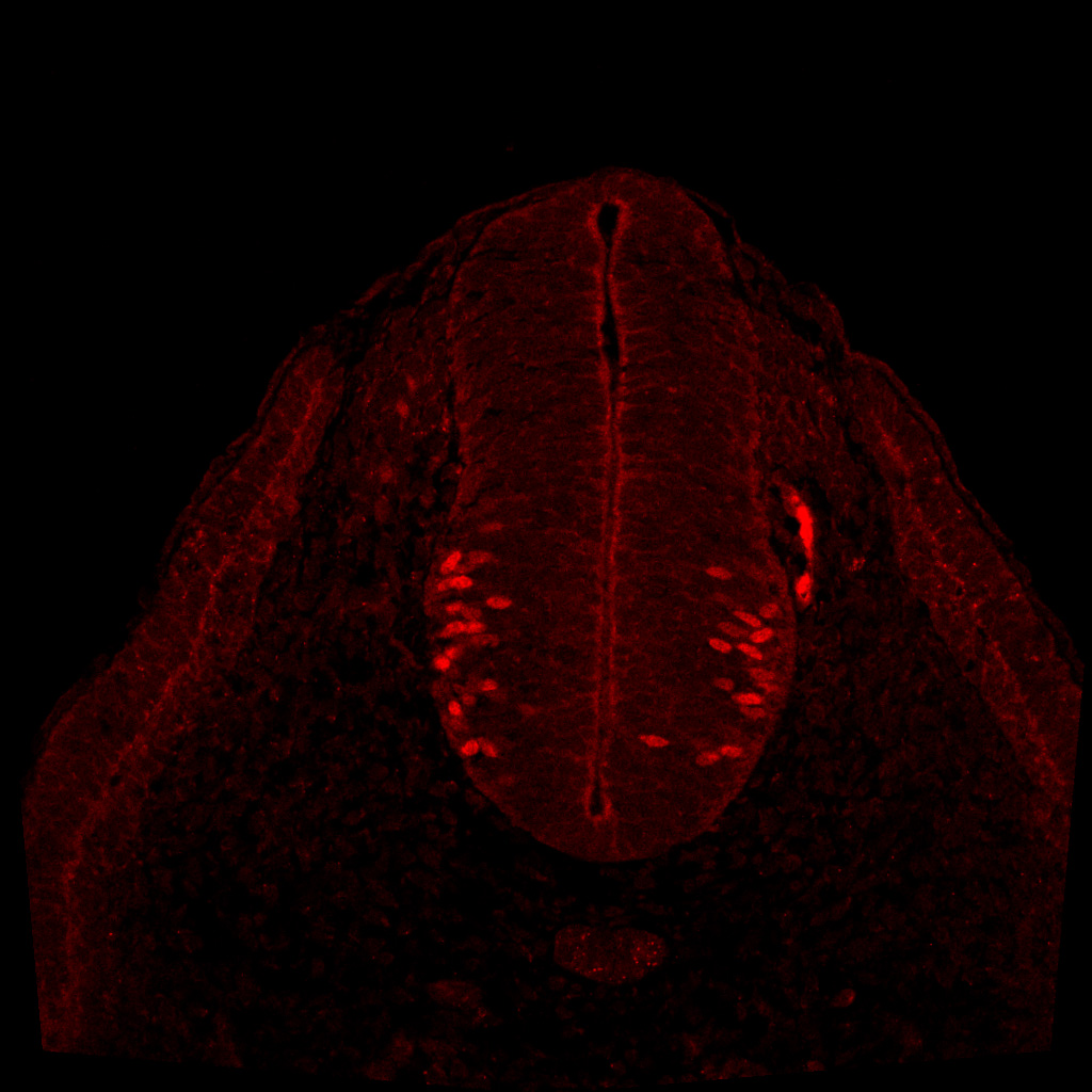 Protein expression in the human embryonic spinal cord