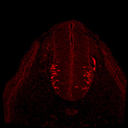 Protein expression in the human embryonic spinal cord