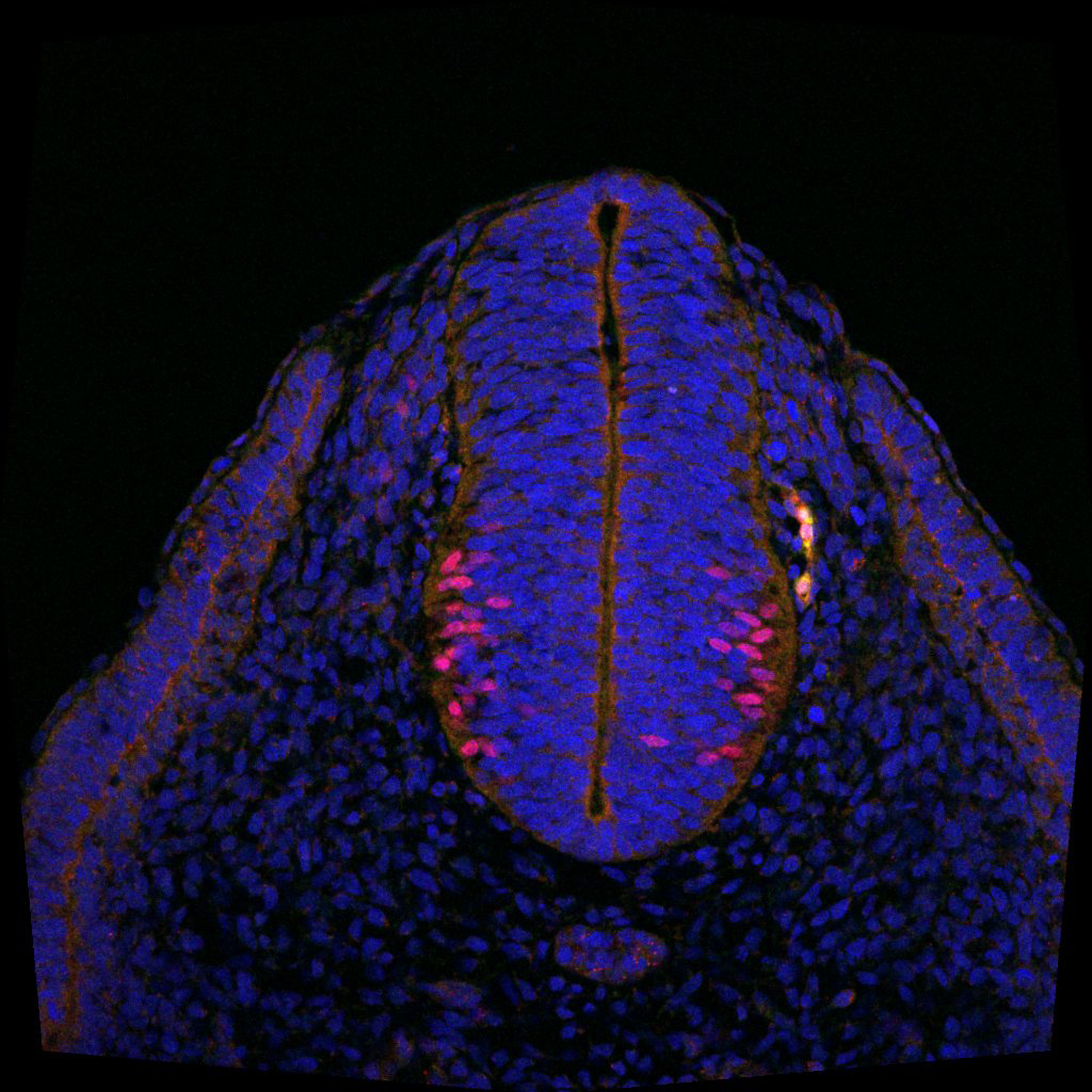 Protein expression in the human embryonic spinal cord