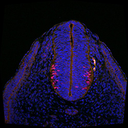 Protein expression in the human embryonic spinal cord