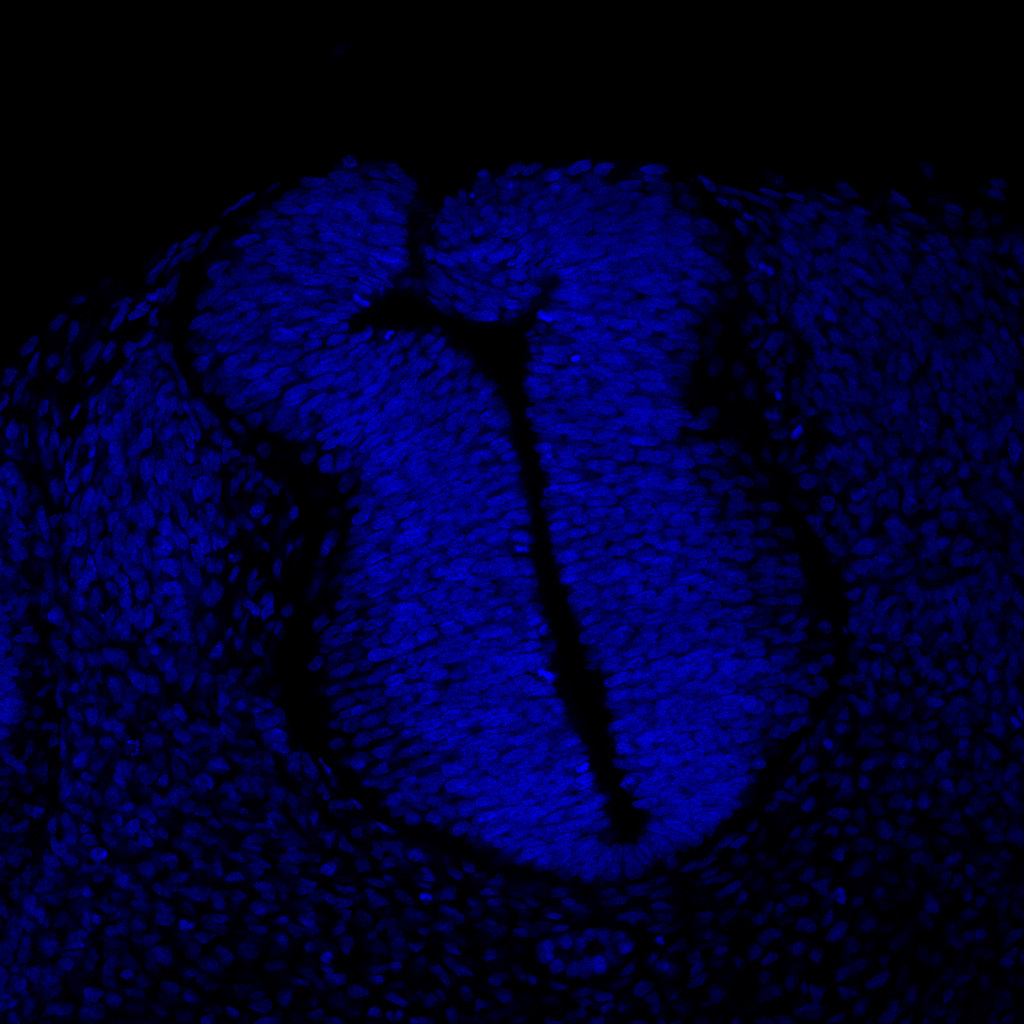 Protein expression in the human embryonic spinal cord