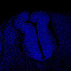 Protein expression in the human embryonic spinal cord
