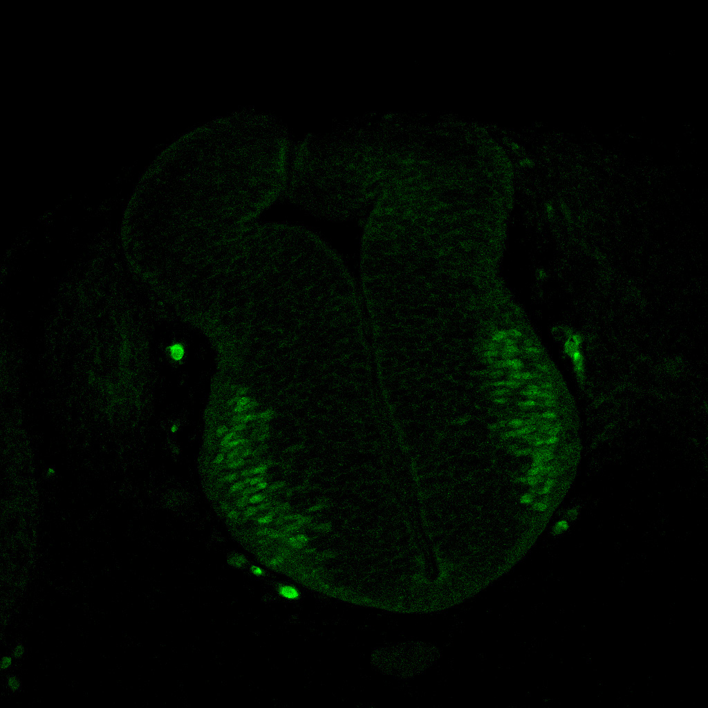 Protein expression in the human embryonic spinal cord