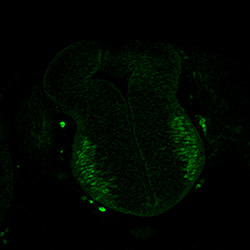 Protein expression in the human embryonic spinal cord