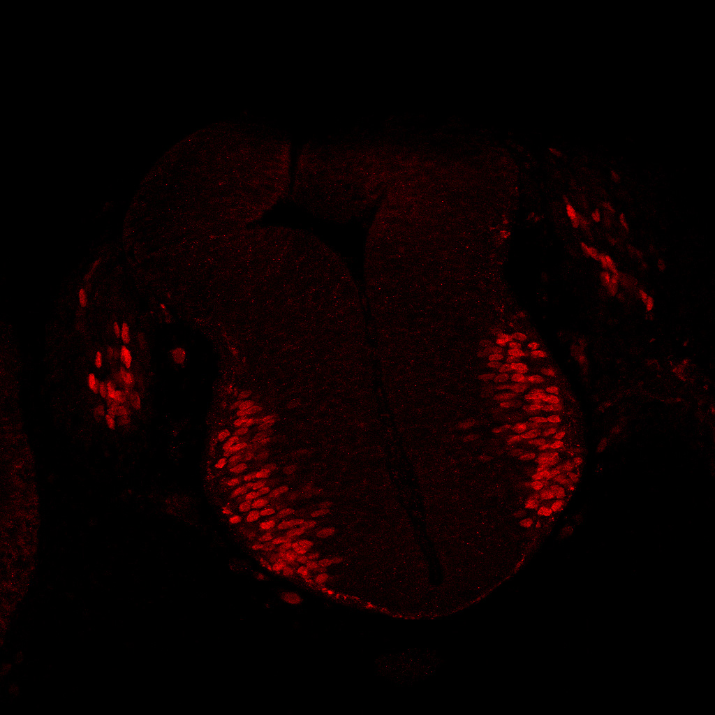 Protein expression in the human embryonic spinal cord