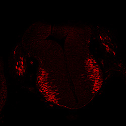 Protein expression in the human embryonic spinal cord