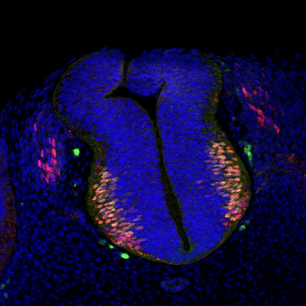 Protein expression in the human embryonic spinal cord