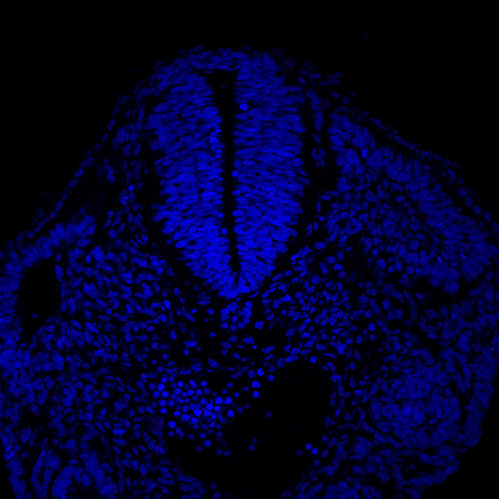 Protein expression in the human embryonic spinal cord