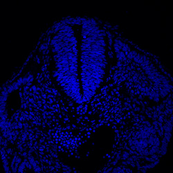 Protein expression in the human embryonic spinal cord