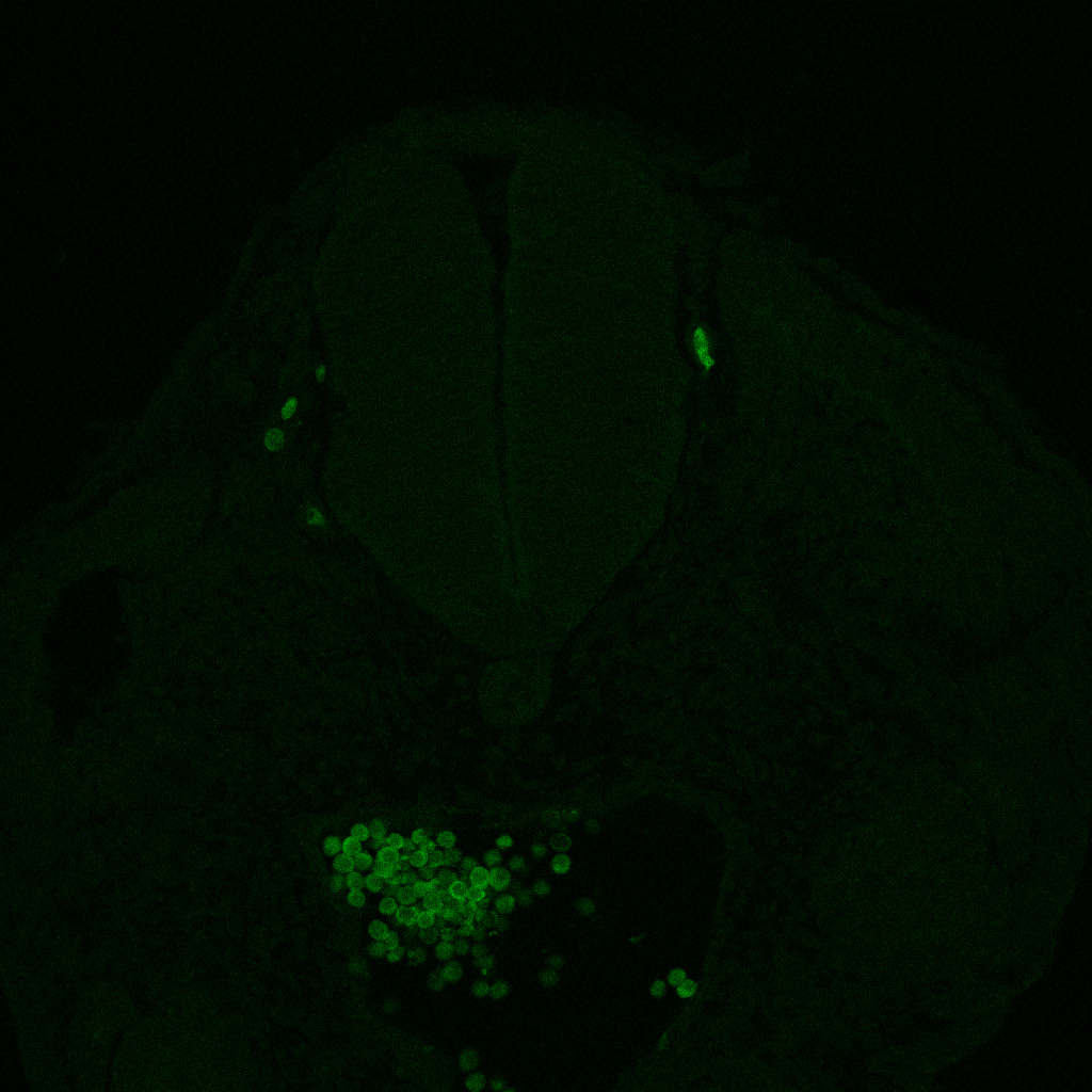 Protein expression in the human embryonic spinal cord