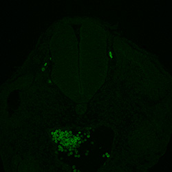 Protein expression in the human embryonic spinal cord