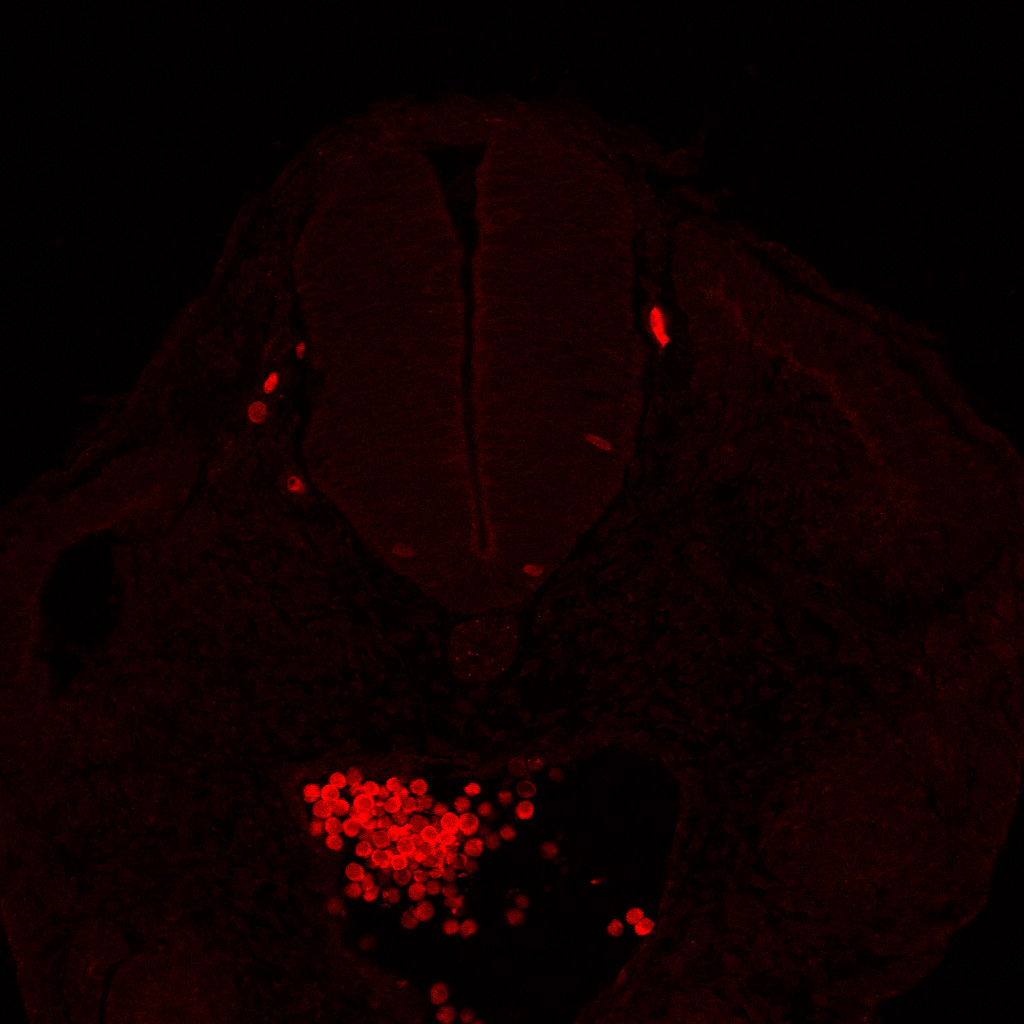 Protein expression in the human embryonic spinal cord