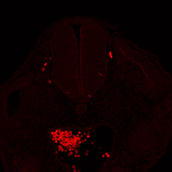 Protein expression in the human embryonic spinal cord