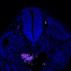 Protein expression in the human embryonic spinal cord