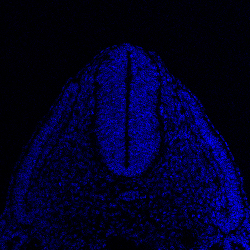 Protein expression in the human embryonic spinal cord