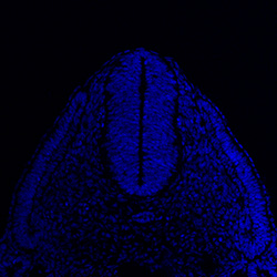 Protein expression in the human embryonic spinal cord