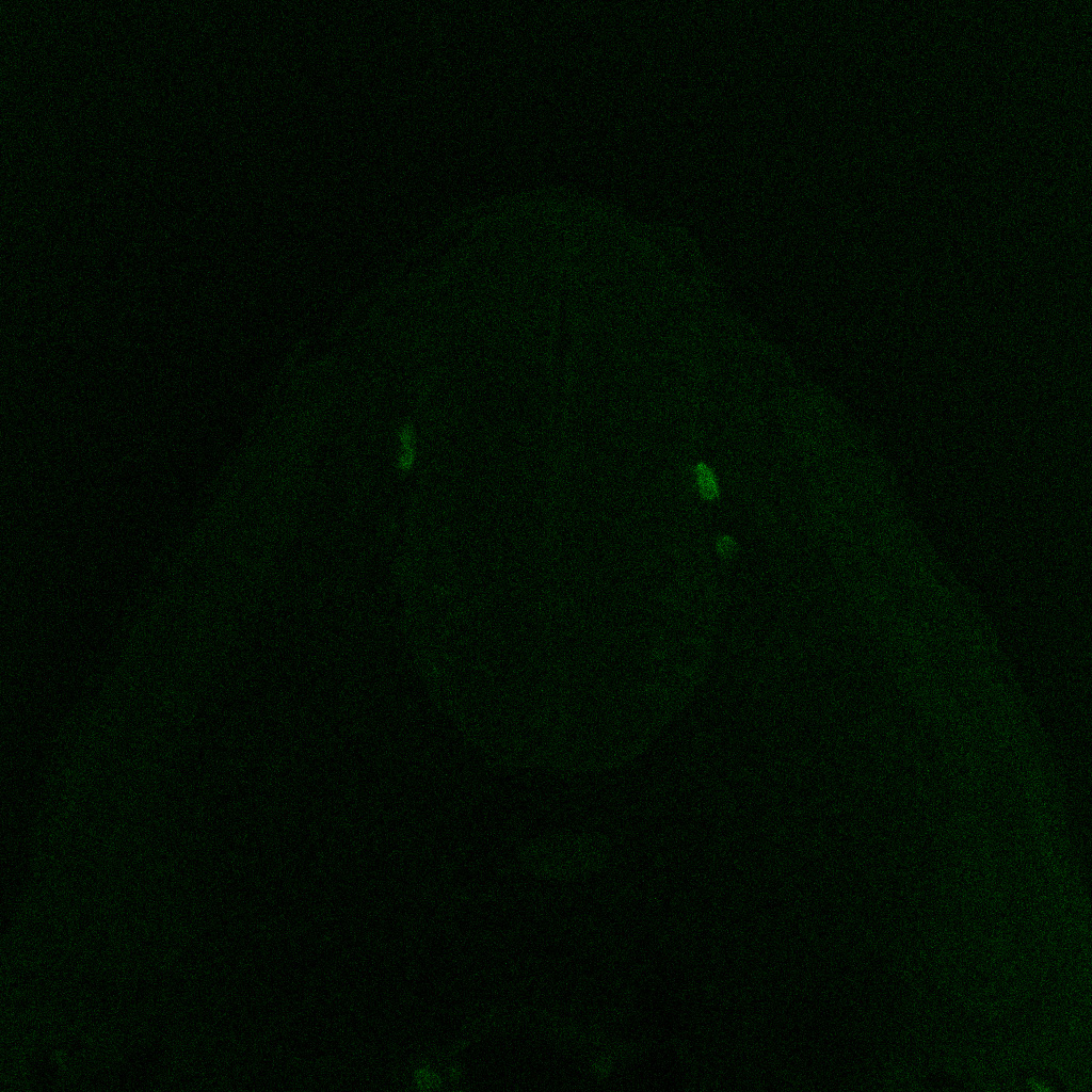 Protein expression in the human embryonic spinal cord