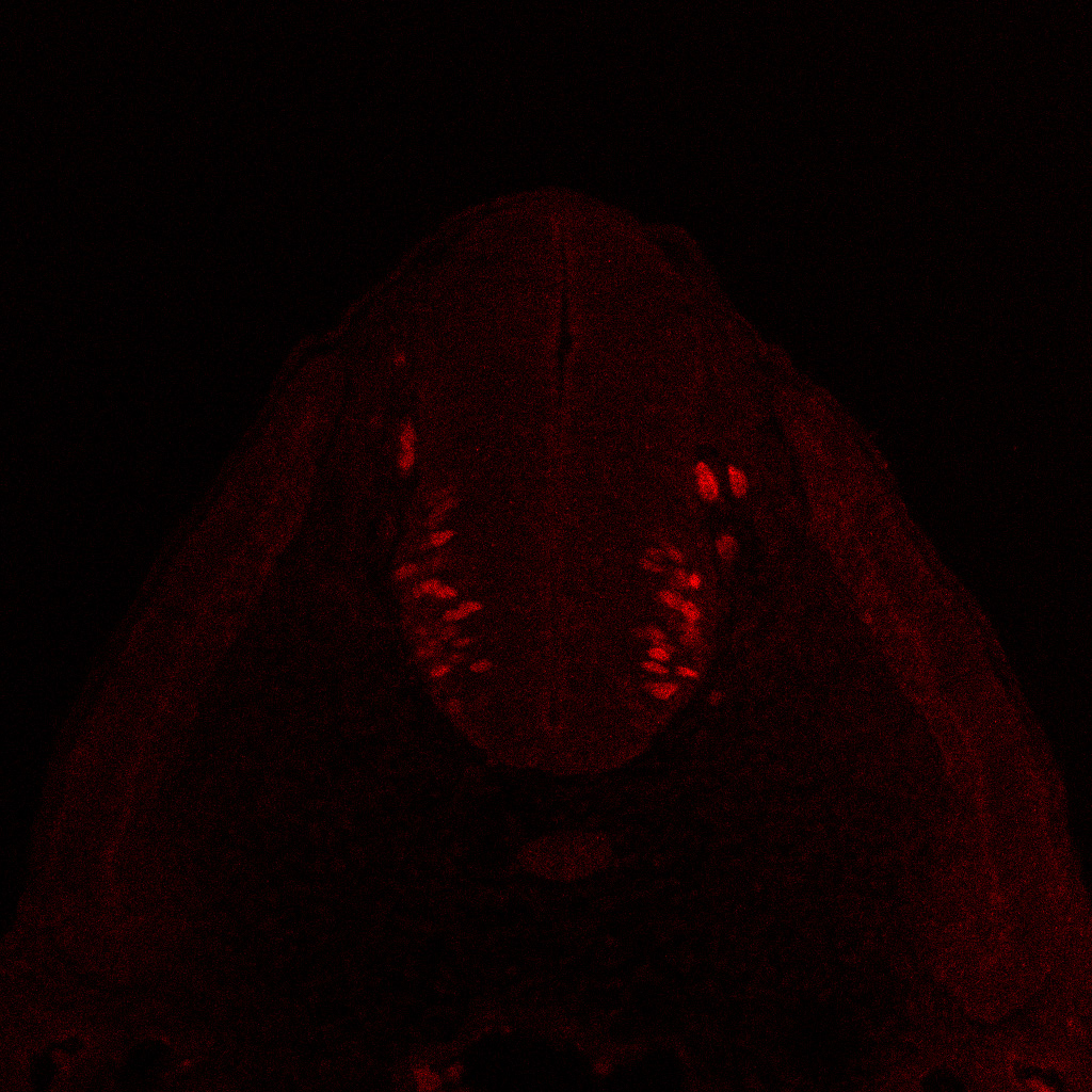 Protein expression in the human embryonic spinal cord