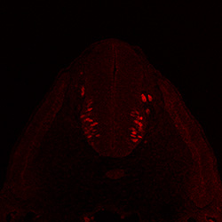 Protein expression in the human embryonic spinal cord