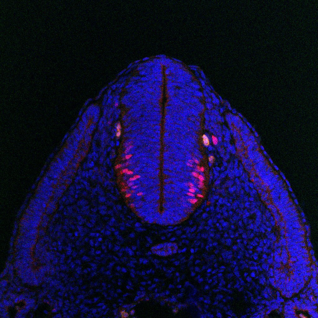 Protein expression in the human embryonic spinal cord