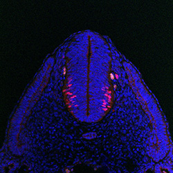 Protein expression in the human embryonic spinal cord