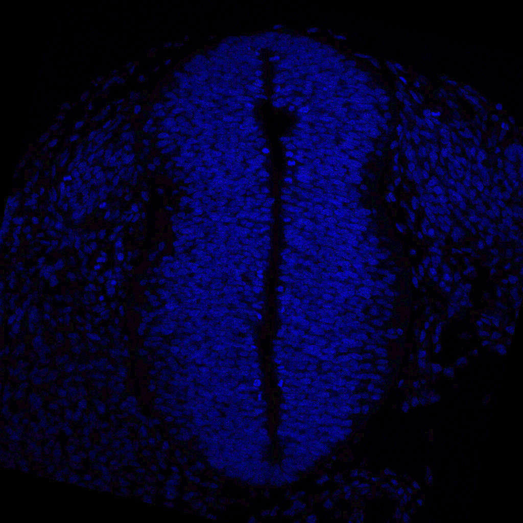 Protein expression in the human embryonic spinal cord