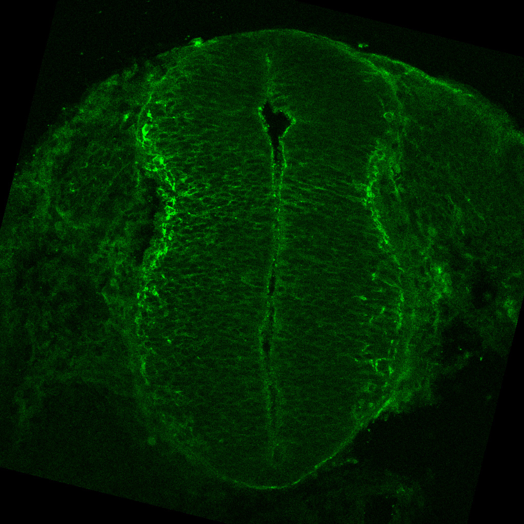 Protein expression in the human embryonic spinal cord