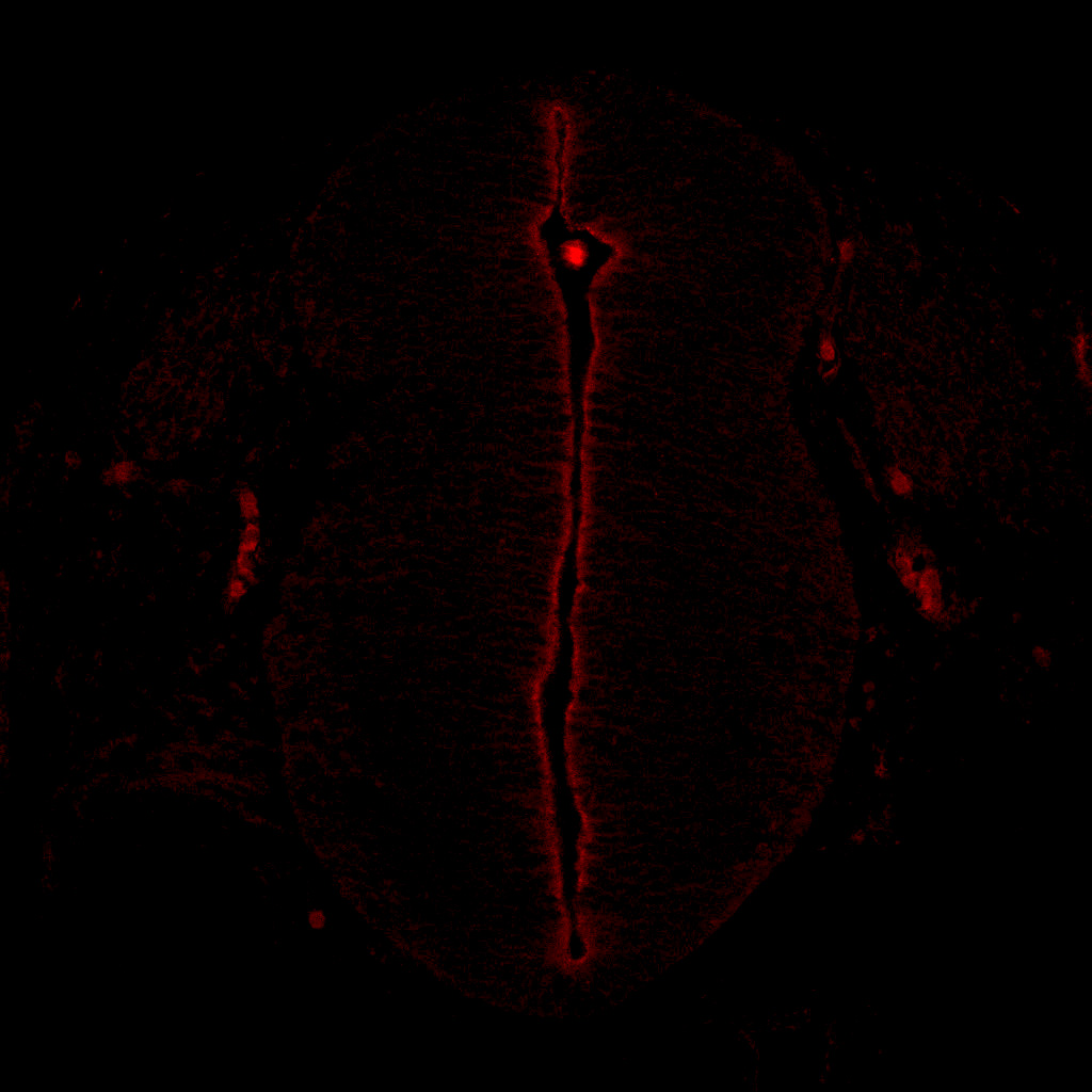 Protein expression in the human embryonic spinal cord