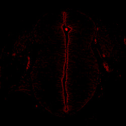 Protein expression in the human embryonic spinal cord