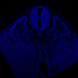 Protein expression in the human embryonic spinal cord