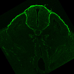 Protein expression in the human embryonic spinal cord
