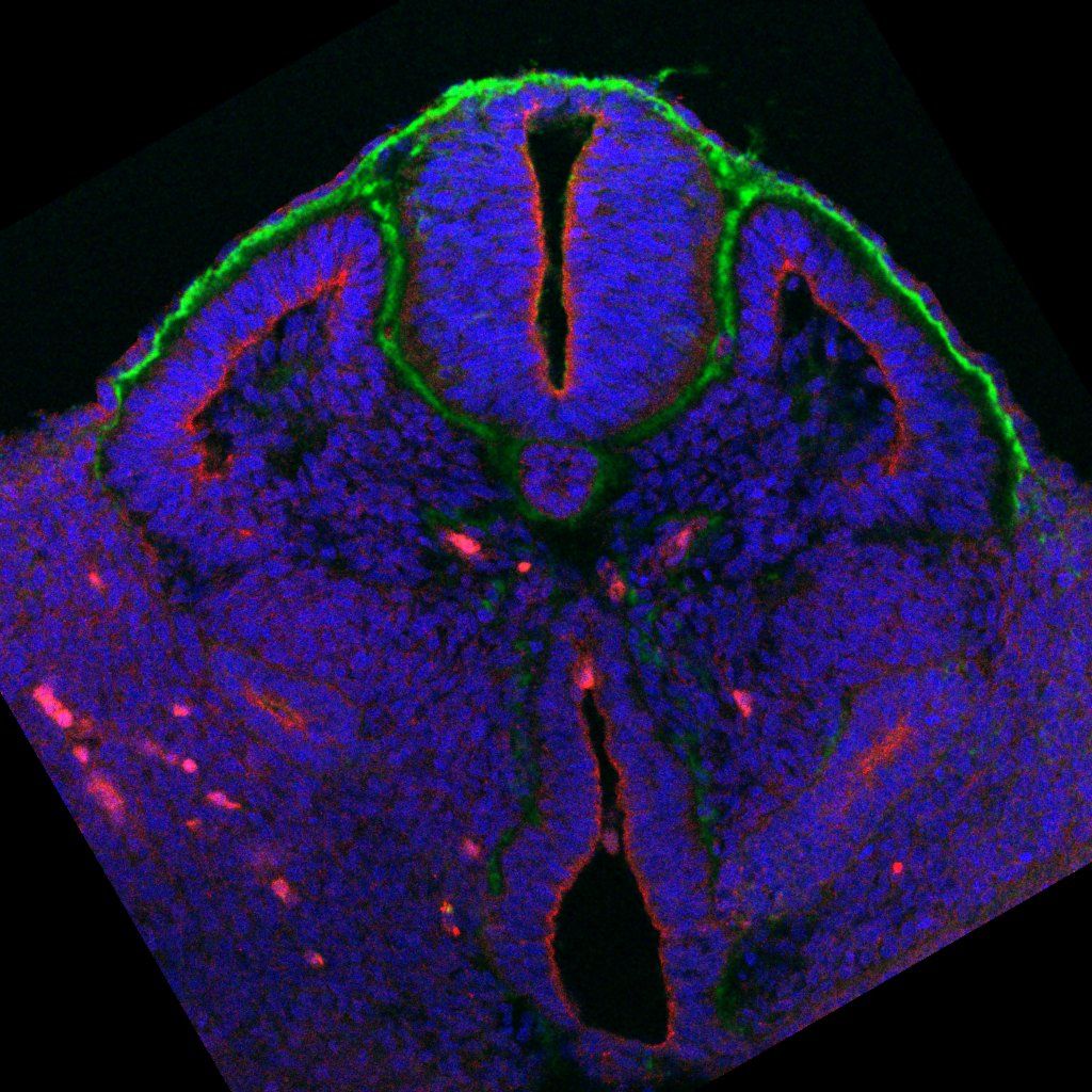 Protein expression in the human embryonic spinal cord