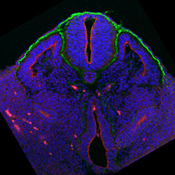 Protein expression in the human embryonic spinal cord