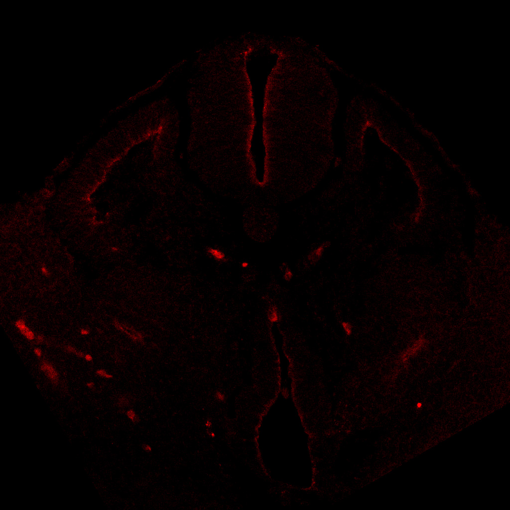 Protein expression in the human embryonic spinal cord